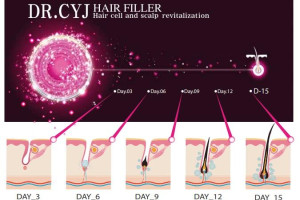 PIERWSZA SKUTECZNA TERAPIA -LECZENIE ŁYSIENIA