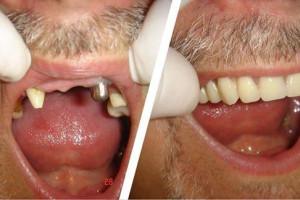 DENTYSTA LONDYN- WITAMY W KLINICE STOMATOLOGICZNEJ