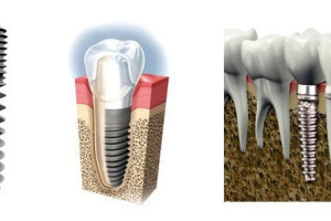 DENTYSTA LONDYN- WITAMY W KLINICE STOMATOLOGICZNEJ