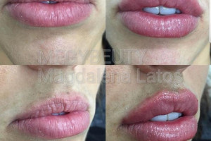 Gabinet Medycyny estetycznej, BOTOX, PRP, Wypełniacze, Leczenie łysienia androgenowego i przebrawień na skórze.