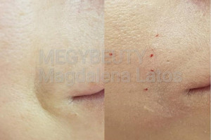 Gabinet Medycyny estetycznej, BOTOX, PRP, Wypełniacze, Leczenie łysienia androgenowego i przebrawień na skórze.