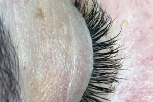 Przedłużanie i zagęszczanie rzęs meteda 1:1